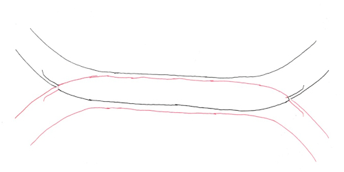 ガントレット(Gantlet)の線路の概念図。2021年(令和3年)11月作成。